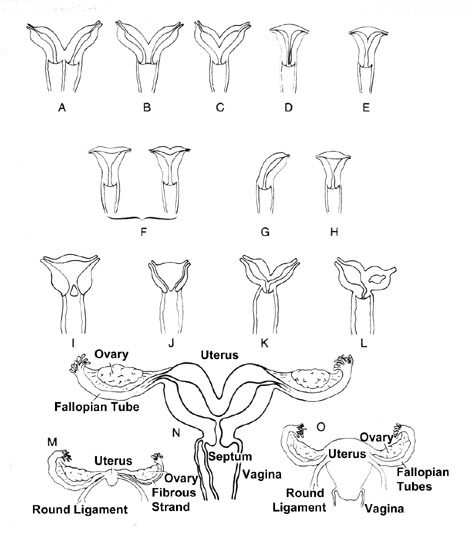 uterus1.jpg